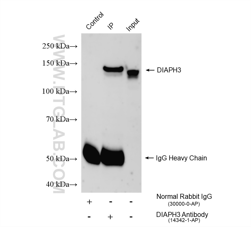 IP experiment of HeLa using 14342-1-AP (same clone as 14342-1-PBS) Immunoprecipitation (IP) experiment of HeLa cells using DIAPH3 Polyclonal antibody (14342-1-AP)