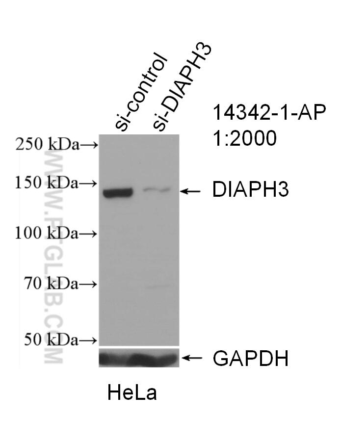 Western Blot (WB) analysis of HeLa cells using DIAPH3 Polyclonal antibody (14342-1-AP)