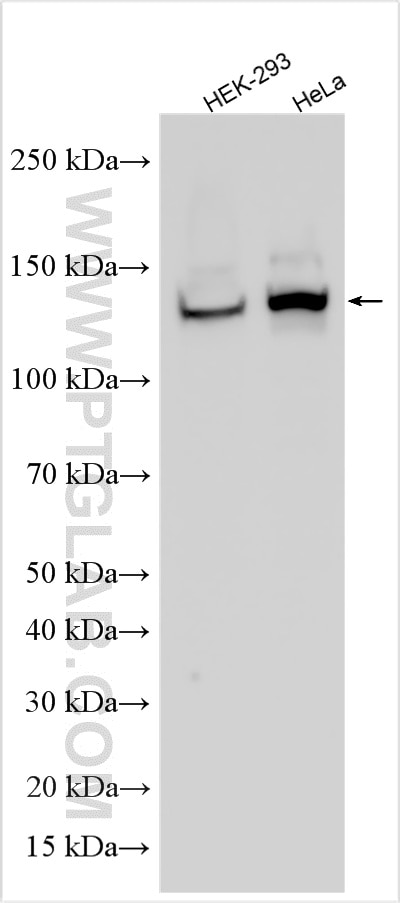 Western Blot (WB) analysis of various lysates using DIAPH3 Polyclonal antibody (14342-1-AP)