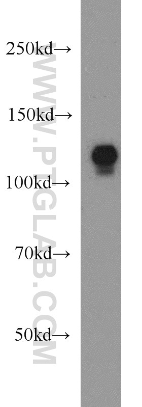 Western Blot (WB) analysis of HeLa cells using DIAPH3 Polyclonal antibody (14342-1-AP)