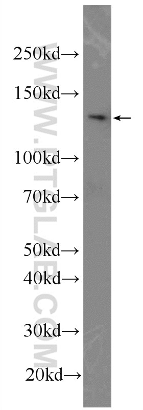 Western Blot (WB) analysis of DU 145 cells using DIAPH3 Polyclonal antibody (14342-1-AP)