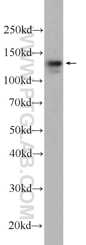 Western Blot (WB) analysis of HEK-293 cells using DIAPH3 Polyclonal antibody (14342-1-AP)