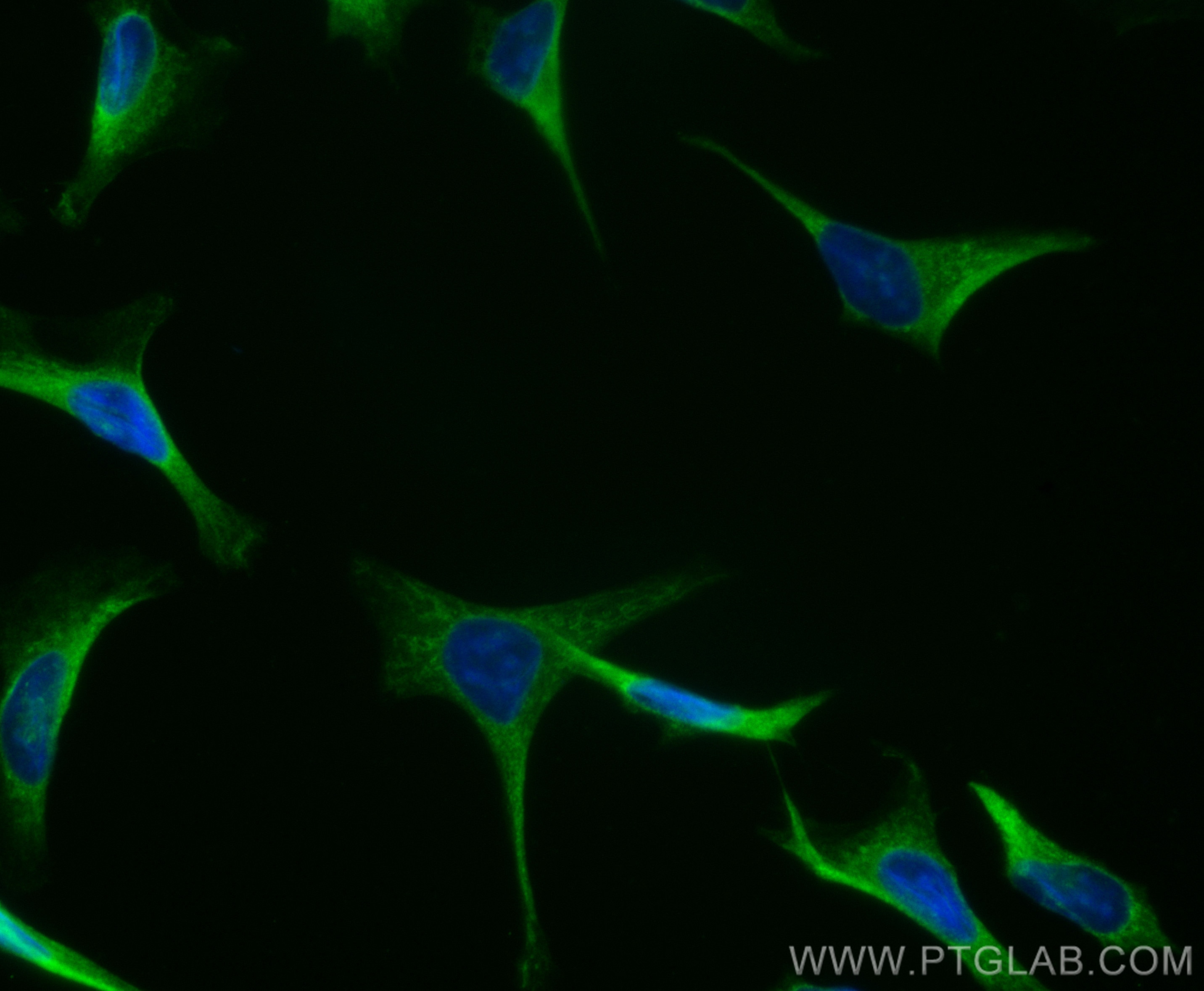 Immunofluorescence (IF) / fluorescent staining of HeLa cells using CoraLite® Plus 488-conjugated DIAPH3 Polyclonal an (CL488-14342)