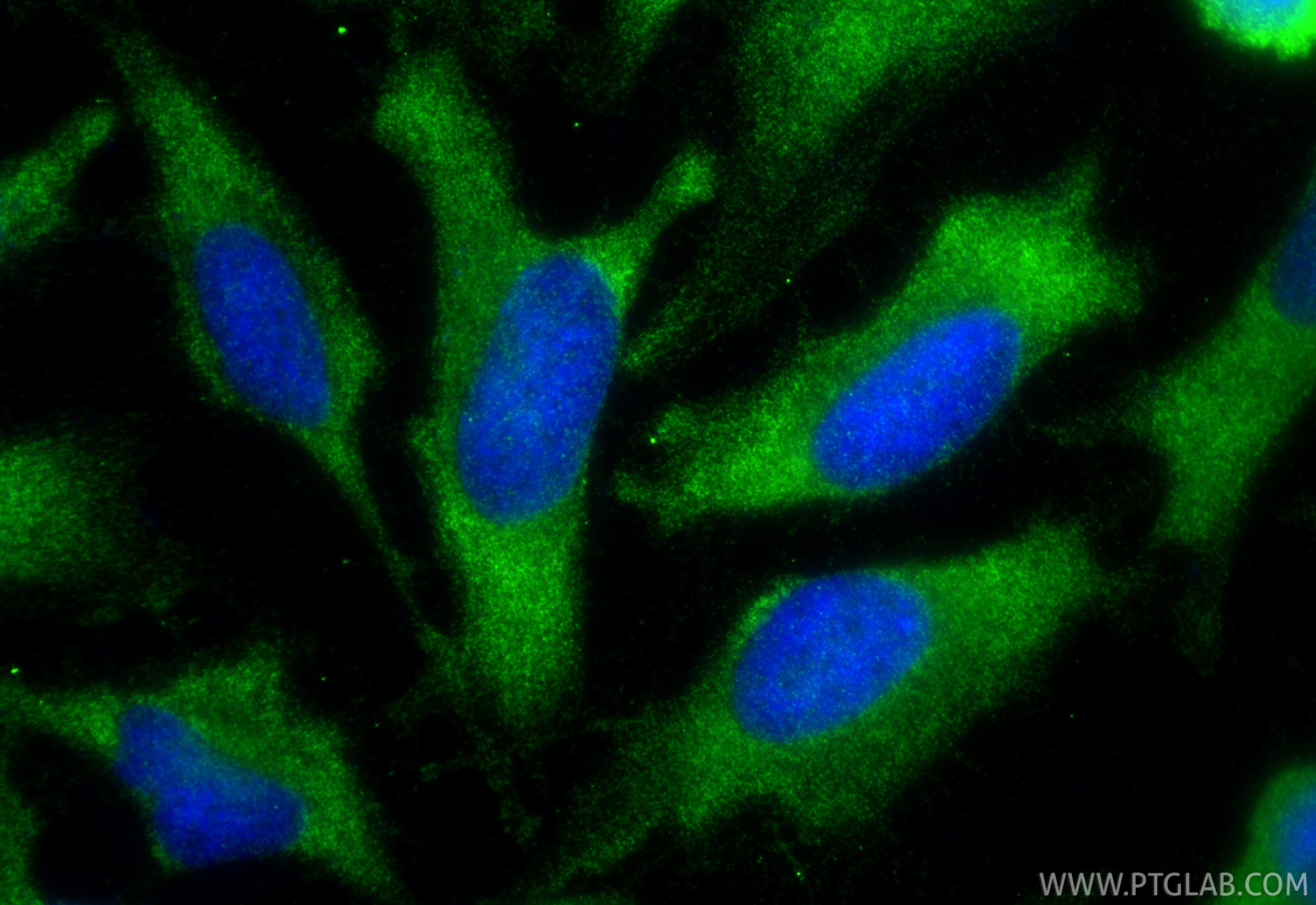 Immunofluorescence (IF) / fluorescent staining of HeLa cells using Multi-rAb® DIAPH3 Multi-Recombinant antibody (RMX00041)