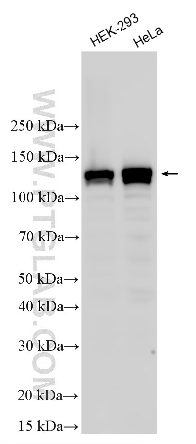 Western Blot (WB) analysis of various lysates using Multi-rAb® DIAPH3 Multi-Recombinant antibody (RMX00041)