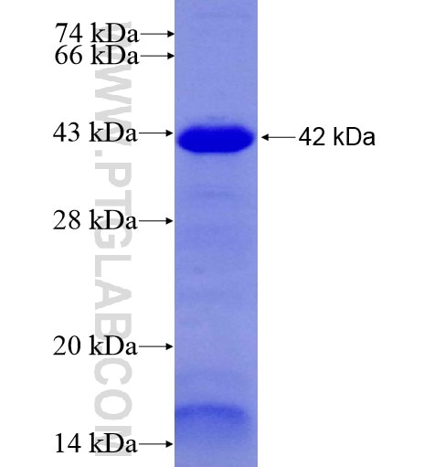 DIAPH3 fusion protein Ag6631 SDS-PAGE
