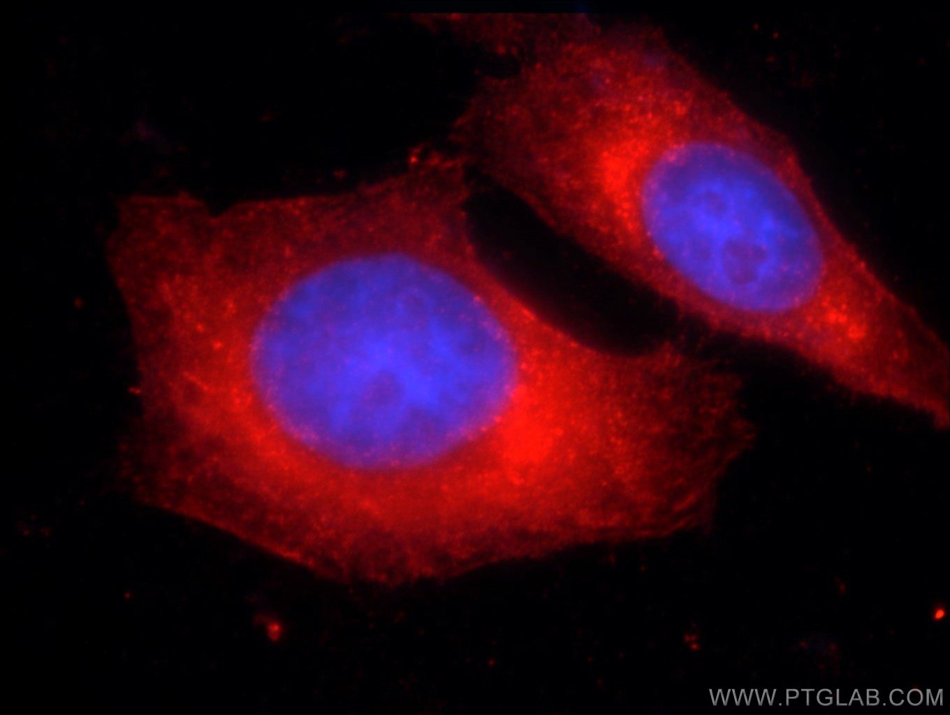 Immunofluorescence (IF) / fluorescent staining of HepG2 cells using DICER1 Polyclonal antibody (20567-1-AP)