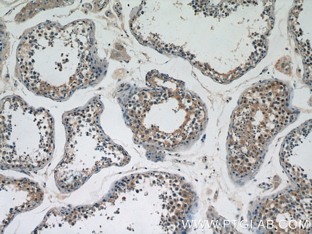 Immunohistochemistry (IHC) staining of human testis tissue using DICER1 Polyclonal antibody (20567-1-AP)