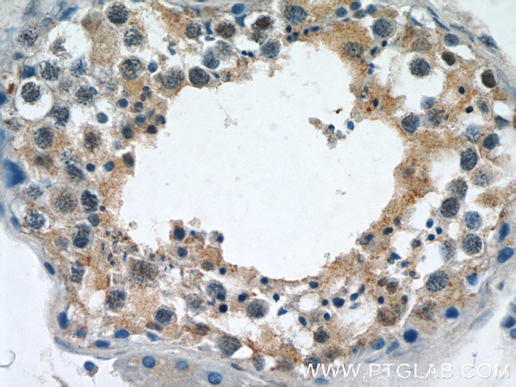 Immunohistochemistry (IHC) staining of human testis tissue using DICER1 Polyclonal antibody (20567-1-AP)