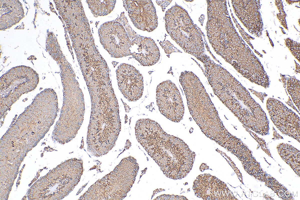 Immunohistochemistry (IHC) staining of mouse testis tissue using DICER1 Polyclonal antibody (20567-1-AP)