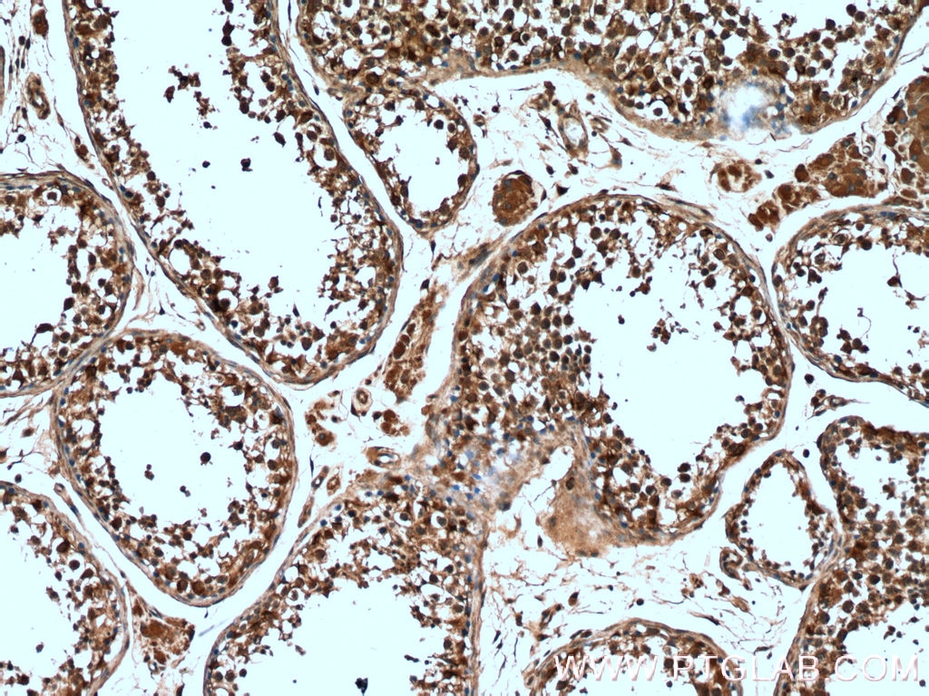 Immunohistochemistry (IHC) staining of human testis tissue using DICER1 Polyclonal antibody (20567-1-AP)