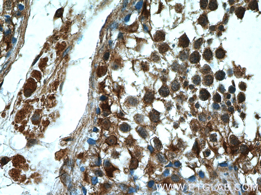 IHC staining of human testis using 20567-1-AP