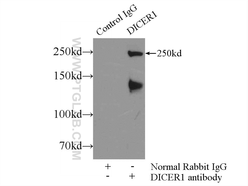 Immunoprecipitation (IP) experiment of Jurkat cells using DICER1 Polyclonal antibody (20567-1-AP)