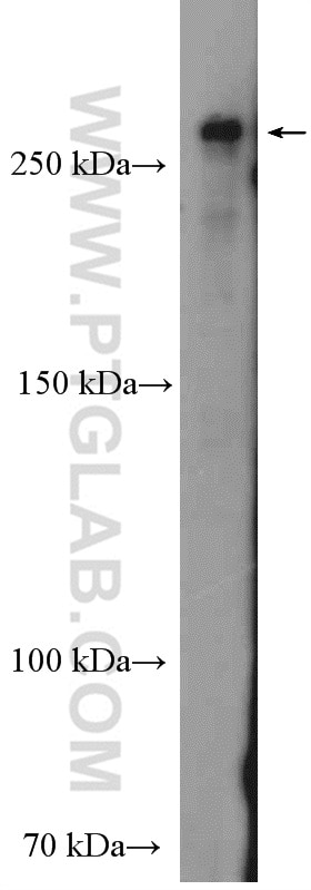 Western Blot (WB) analysis of HeLa cells using DICER1 Polyclonal antibody (20567-1-AP)