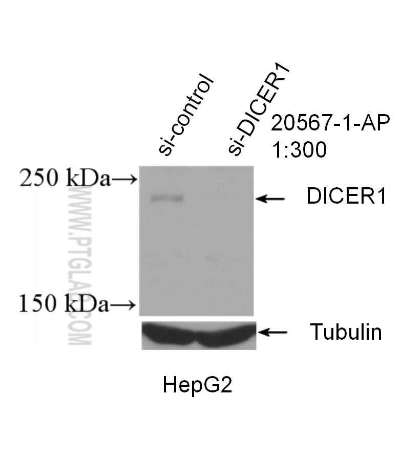 Western Blot (WB) analysis of HepG2 cells using DICER1 Polyclonal antibody (20567-1-AP)