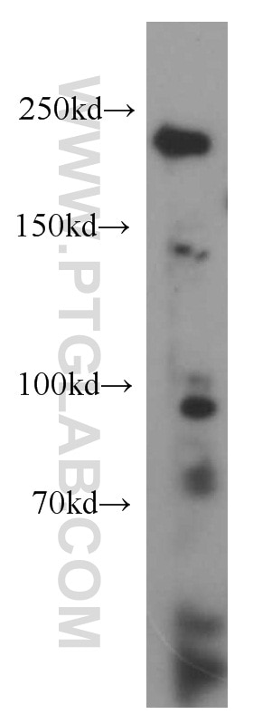 Western Blot (WB) analysis of K-562 cells using DICER1 Polyclonal antibody (20567-1-AP)