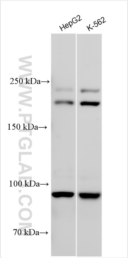 Western Blot (WB) analysis of various lysates using DICER1 Polyclonal antibody (29984-1-AP)