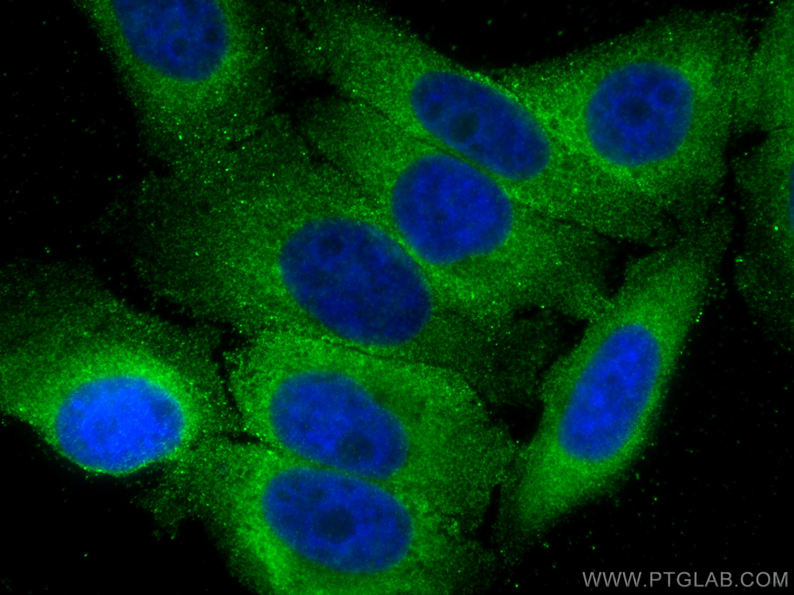 Immunofluorescence (IF) / fluorescent staining of HepG2 cells using DICER1 Monoclonal antibody (68375-1-Ig)