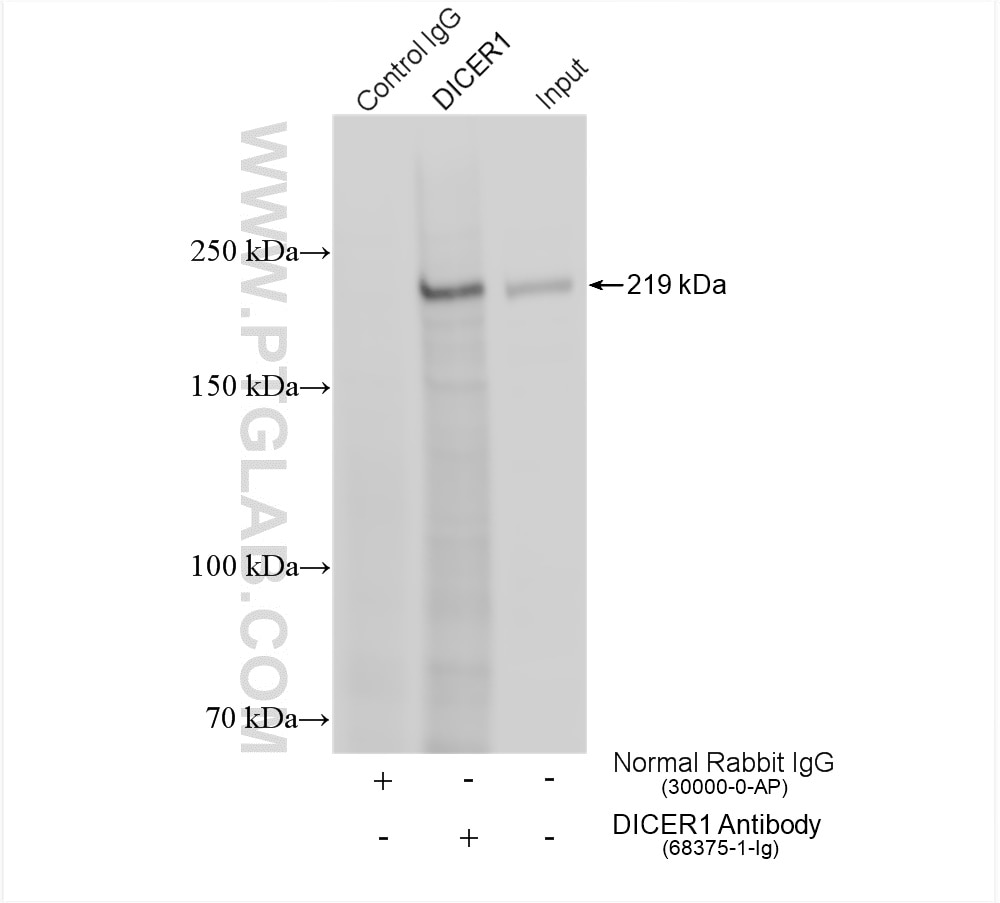 Immunoprecipitation (IP) experiment of Jurkat cells using DICER1 Monoclonal antibody (68375-1-Ig)