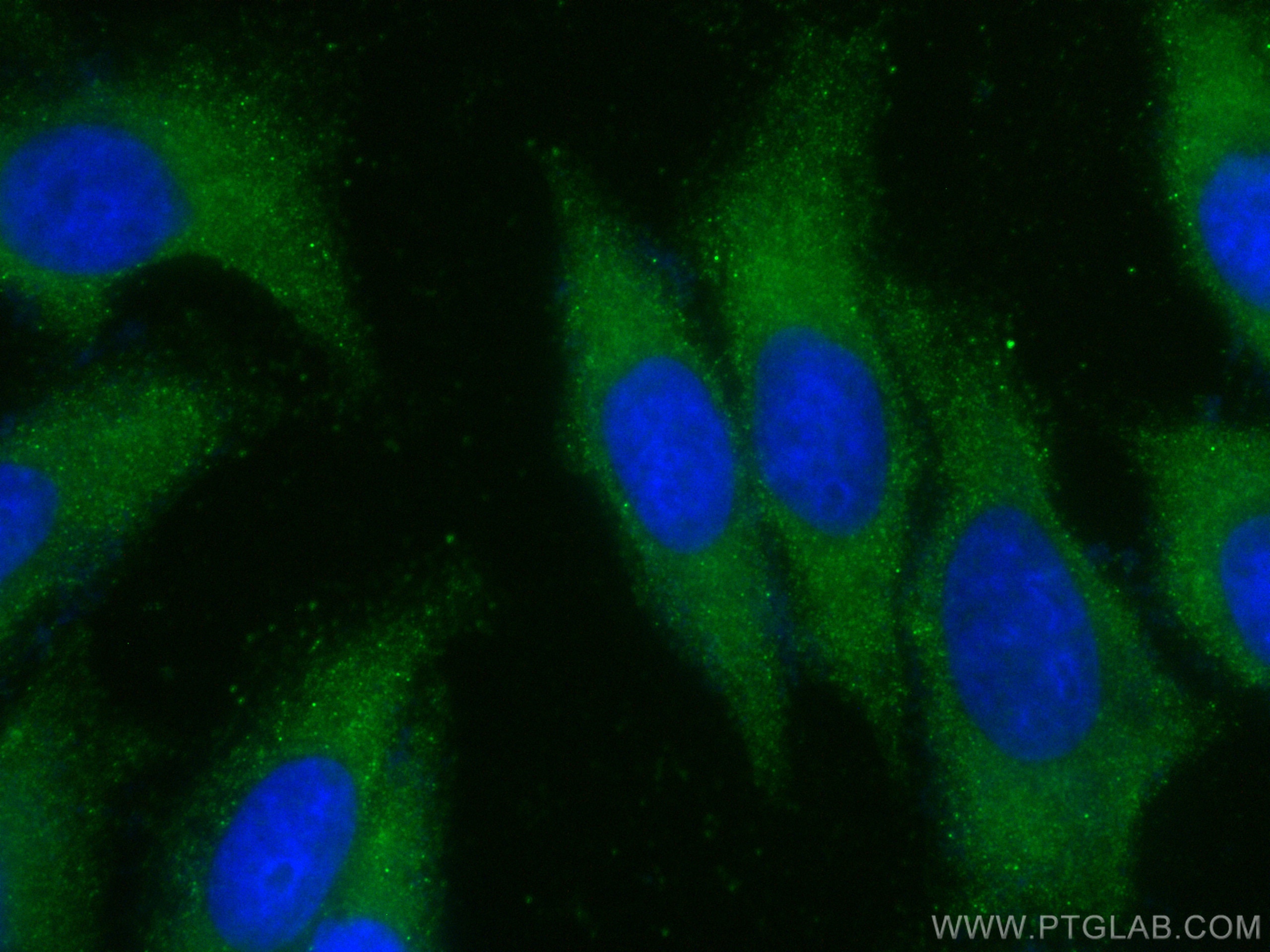 Immunofluorescence (IF) / fluorescent staining of HepG2 cells using CoraLite® Plus 488-conjugated DICER1 Polyclonal an (CL488-20567)