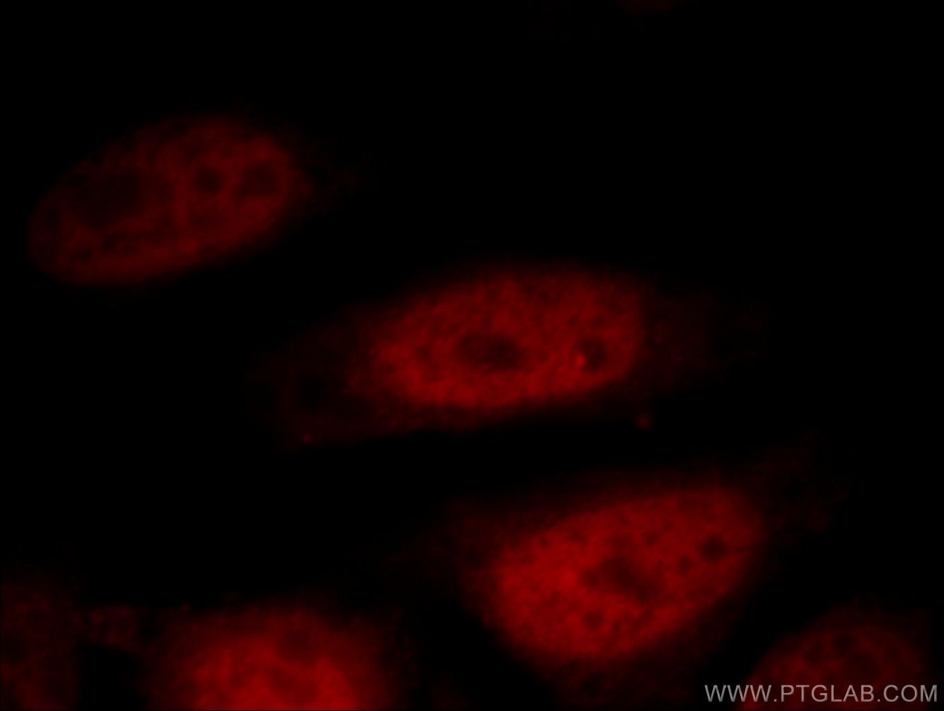 Immunofluorescence (IF) / fluorescent staining of HepG2 cells using DIDO1 Polyclonal antibody (10183-1-AP)