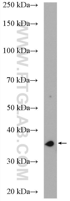 Western Blot (WB) analysis of HeLa cells using DIMT1L Polyclonal antibody (15563-1-AP)