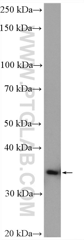 Western Blot (WB) analysis of Jurkat cells using DIMT1L Polyclonal antibody (15563-1-AP)