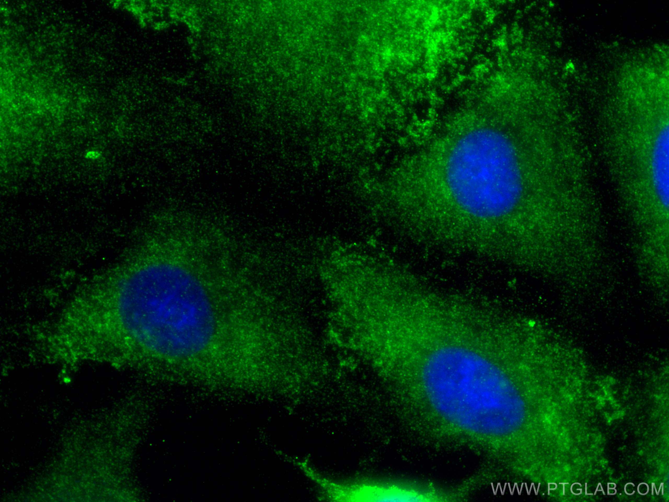 Immunofluorescence (IF) / fluorescent staining of A549 cells using DIO1 Polyclonal antibody (11790-1-AP)