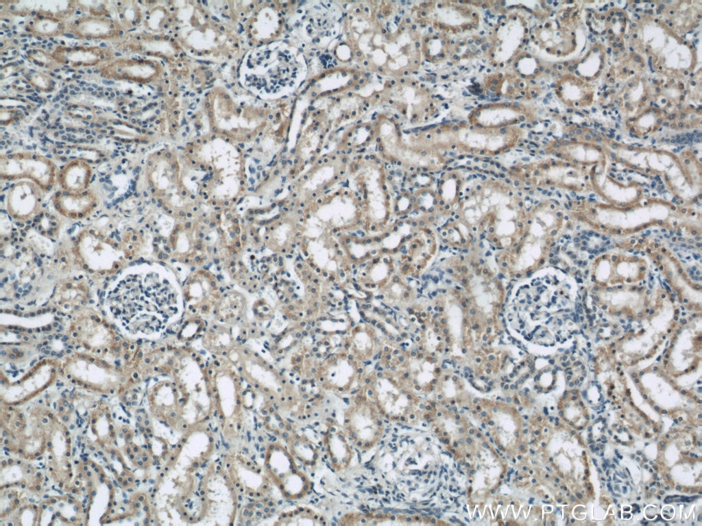 Immunohistochemistry (IHC) staining of human kidney tissue using DIO1 Polyclonal antibody (11790-1-AP)