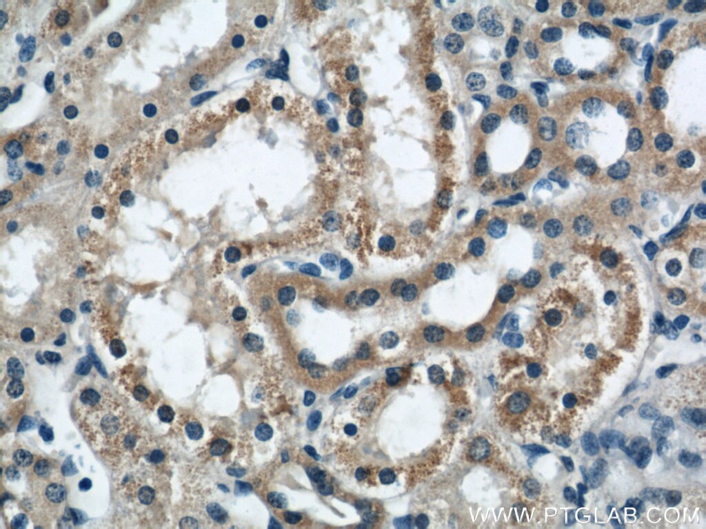 Immunohistochemistry (IHC) staining of human kidney tissue using DIO1 Polyclonal antibody (11790-1-AP)