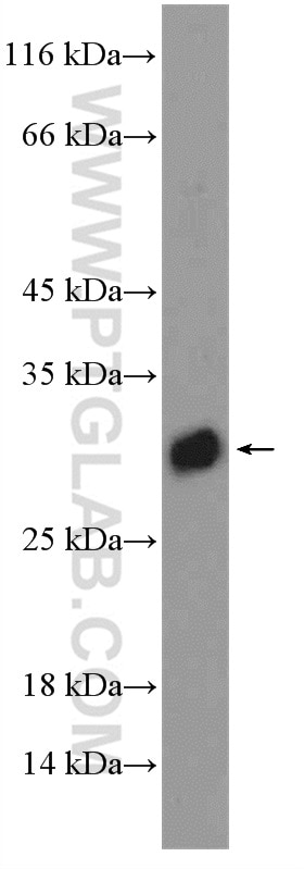 Western Blot (WB) analysis of mouse lung tissue using DIO1 Polyclonal antibody (11790-1-AP)