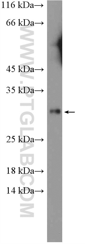 Western Blot (WB) analysis of mouse ovary tissue using DIO1 Polyclonal antibody (11790-1-AP)