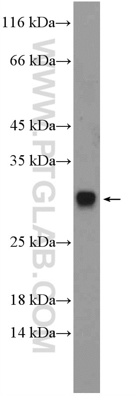 Western Blot (WB) analysis of rat lung tissue using DIO1 Polyclonal antibody (11790-1-AP)