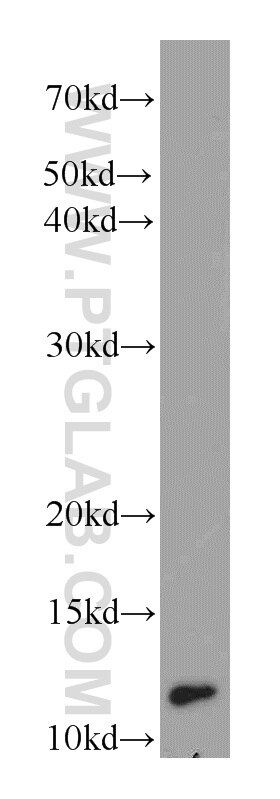 Western Blot (WB) analysis of U-937 cells using DIO1 Polyclonal antibody (11790-1-AP)