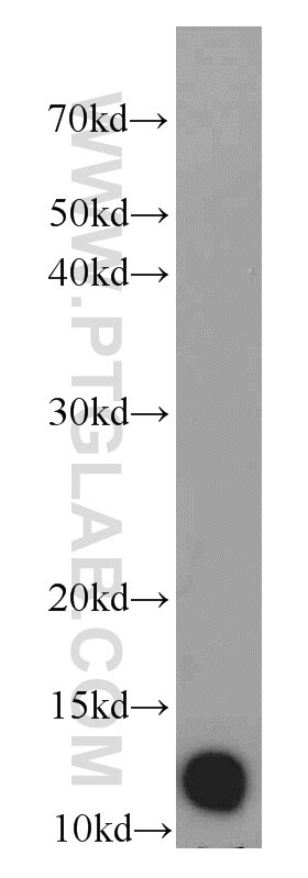 Western Blot (WB) analysis of A549 cells using DIO1 Polyclonal antibody (11790-1-AP)