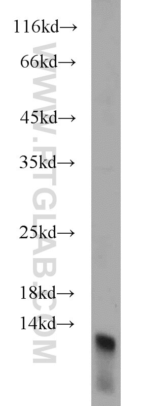 Western Blot (WB) analysis of HeLa cells using DIO1 Polyclonal antibody (11790-1-AP)