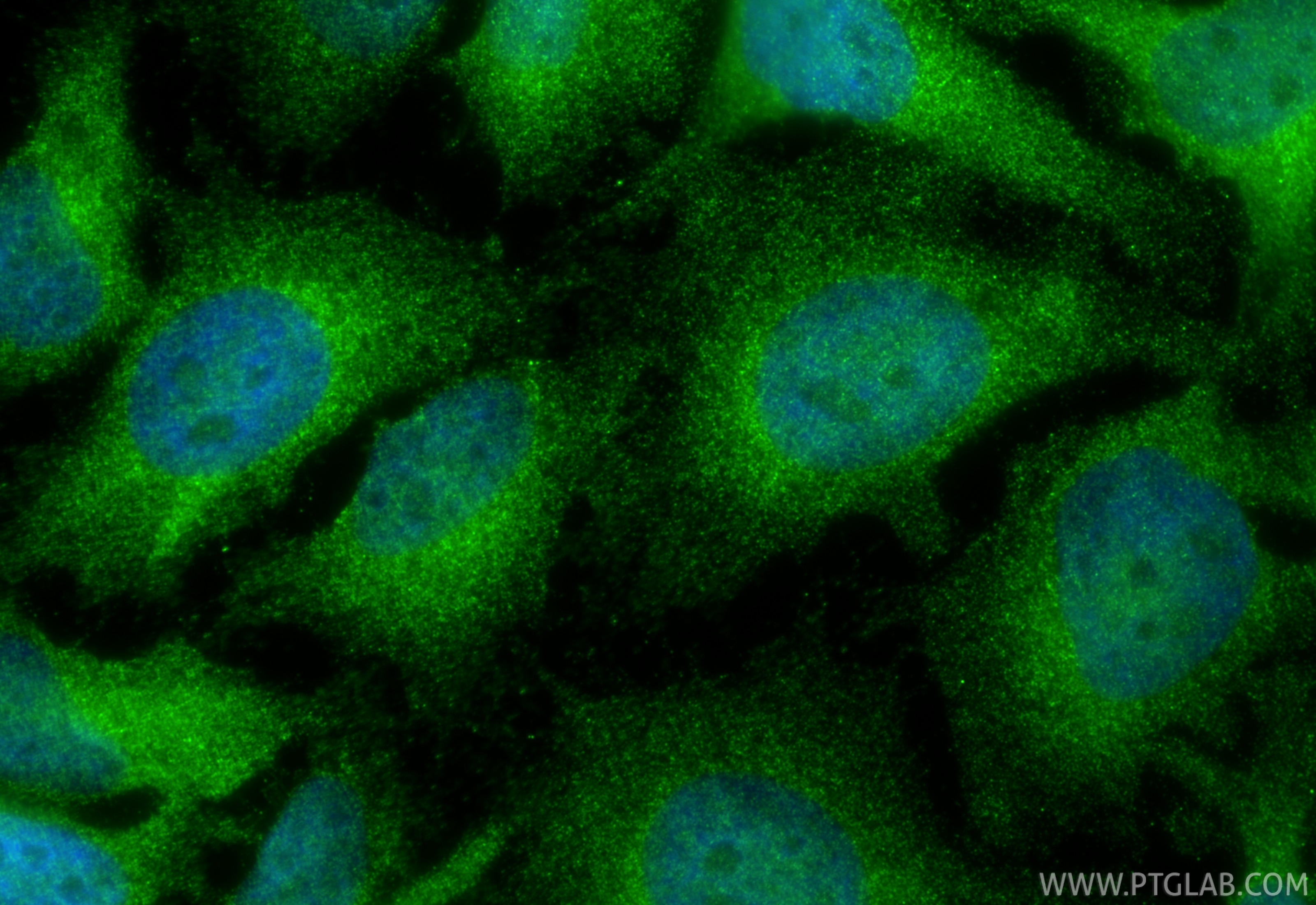 Immunofluorescence (IF) / fluorescent staining of HeLa cells using DIO2 Polyclonal antibody (26513-1-AP)