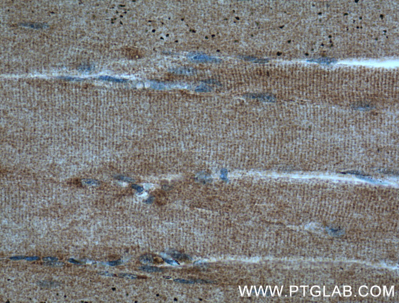 Immunohistochemistry (IHC) staining of human skeletal muscle tissue using DIO2 Polyclonal antibody (26513-1-AP)