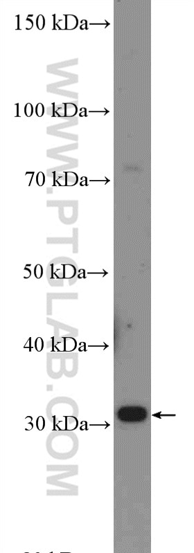 Western Blot (WB) analysis of mouse skeletal muscle tissue using DIO2 Polyclonal antibody (26513-1-AP)
