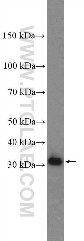 Western Blot (WB) analysis of MCF-7 cells using DIO2 Polyclonal antibody (26513-1-AP)