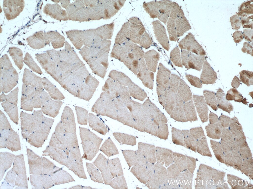 Immunohistochemistry (IHC) staining of mouse skeletal muscle tissue using DIO2 Monoclonal antibody (66813-1-Ig)