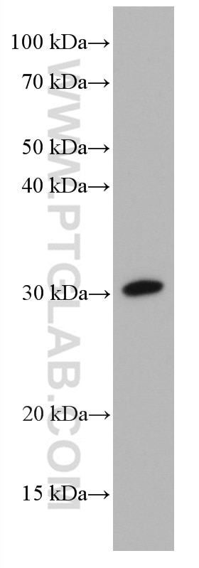 Western Blot (WB) analysis of T-47D cells using DIO2 Monoclonal antibody (66813-1-Ig)