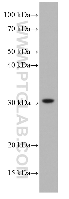 Western Blot (WB) analysis of LNCaP cells using DIO2 Monoclonal antibody (66813-1-Ig)