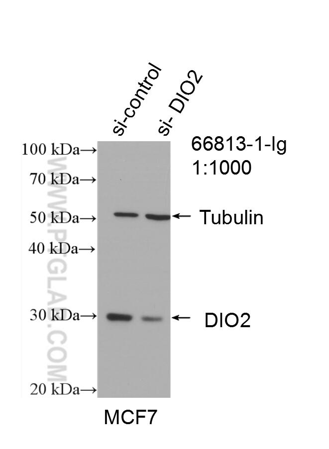Western Blot (WB) analysis of MCF-7 cells using DIO2 Monoclonal antibody (66813-1-Ig)