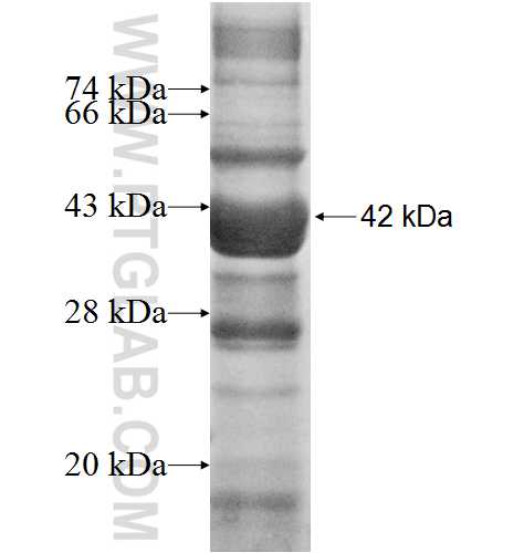 DIP2A fusion protein Ag5778 SDS-PAGE