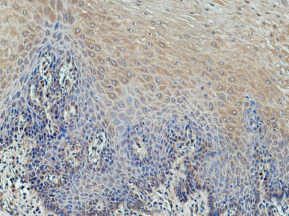Immunohistochemistry (IHC) staining of human oesophagus tissue using DIRAS1 Polyclonal antibody (12634-1-AP)