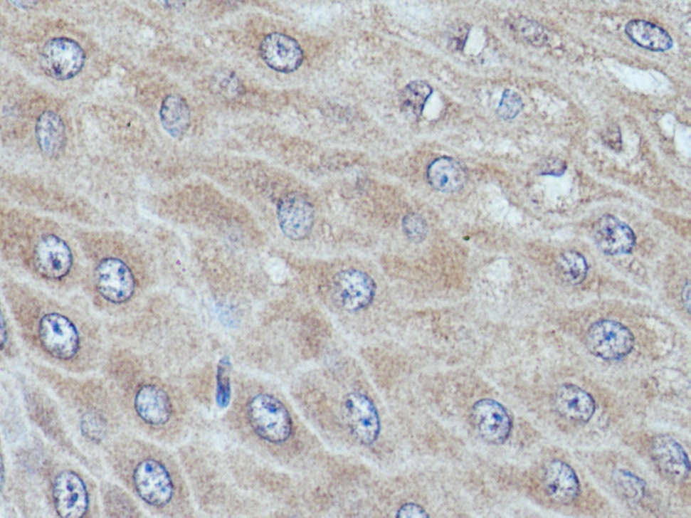 Immunohistochemistry (IHC) staining of human oesophagus tissue using DIRAS1 Polyclonal antibody (12634-1-AP)