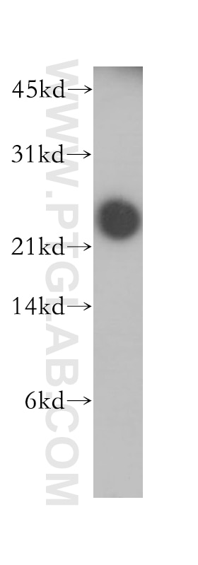 Western Blot (WB) analysis of MCF-7 cells using DIRAS1 Polyclonal antibody (12634-1-AP)