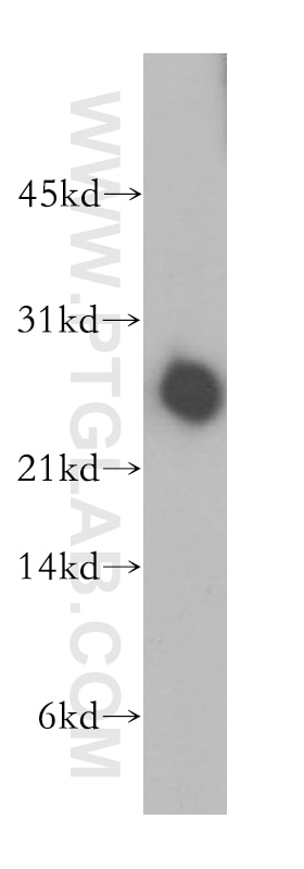 Western Blot (WB) analysis of human brain tissue using DIRAS1 Polyclonal antibody (12634-1-AP)