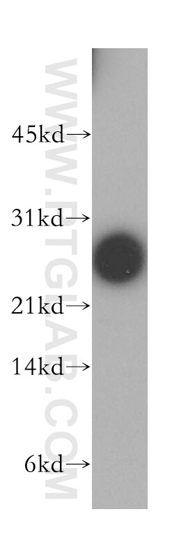 Western Blot (WB) analysis of human brain tissue using DIRAS1 Polyclonal antibody (12634-1-AP)